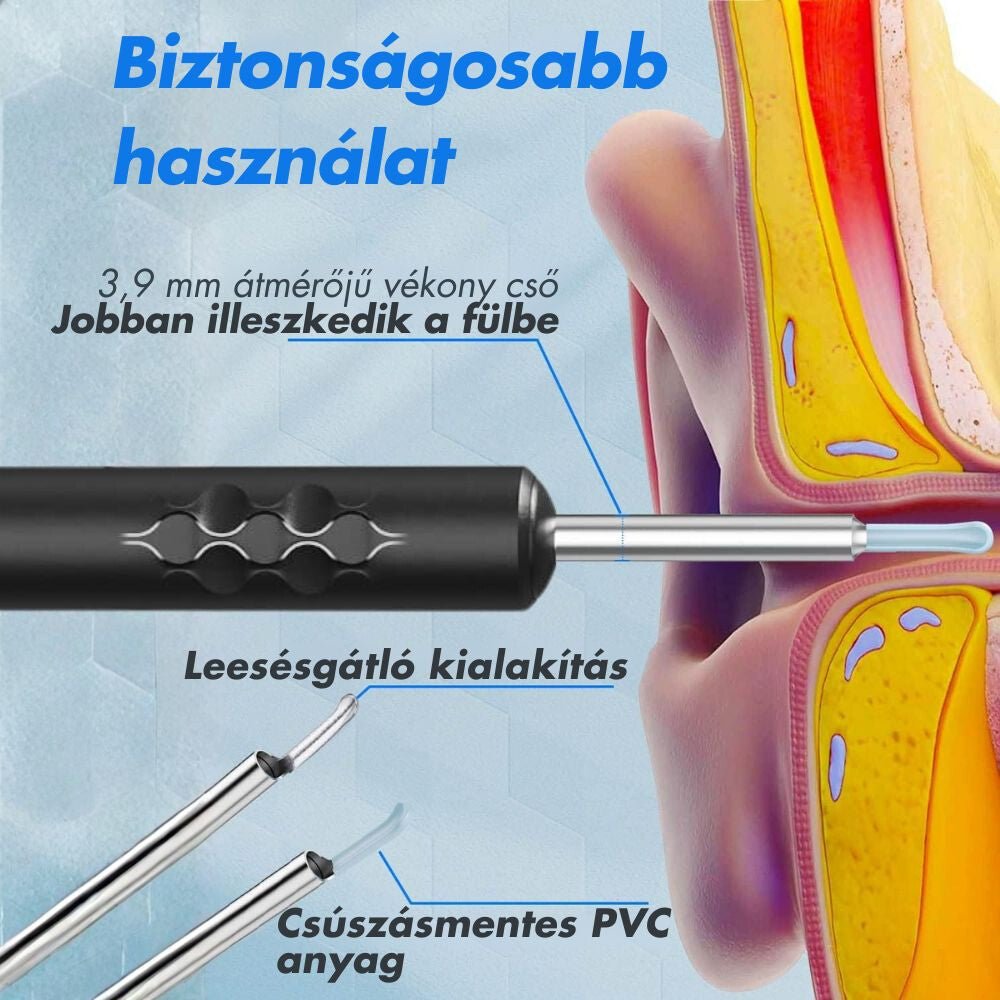 WUDAOPU P90 Fülzsír Eltávolító Készlet, 2300p HD Kamerával - BShopy2300p HD fülkamerabiztonságos fülápolásfülzsír eltávolító eszközX001NQYGCV_5