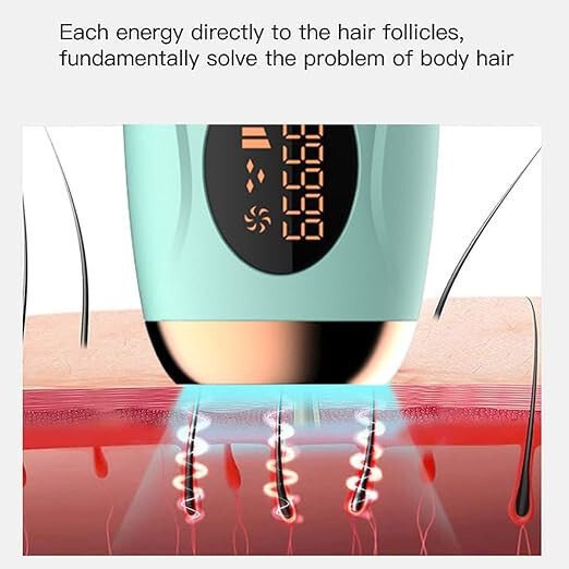 IPL Otthoni Szőrtelenítő - Türkizzöld/Bronz, 999 999 villanás, 5 fokozat - BShopy