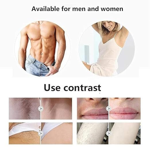 IPL Otthoni Szőrtelenítő - Türkizzöld/Bronz, 999 999 villanás, 5 fokozat - BShopy